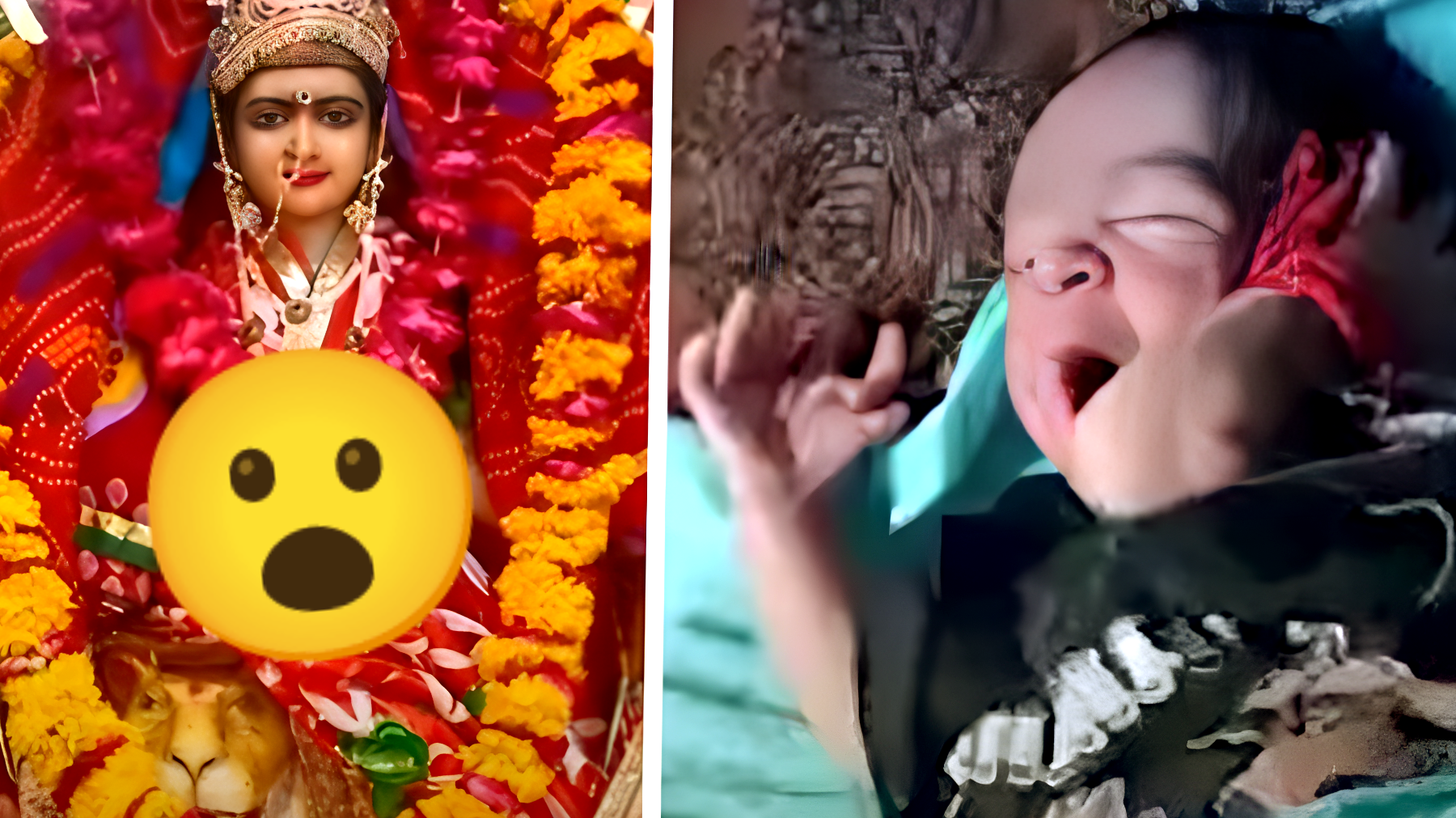 La bambina indiana che ha 26 dita: è la reincarnazione di una divinità?
